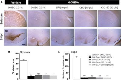 Intrapallidal injection of cannabidiol or a selective GPR55 antagonist decreases motor asymmetry and improves fine motor skills in hemiparkinsonian rats